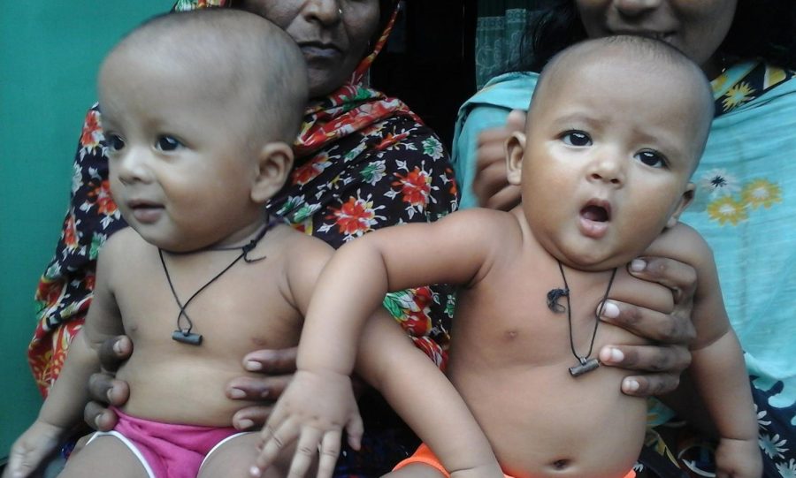An increase in twin births in poorer countries can be both a blessing and a burden.